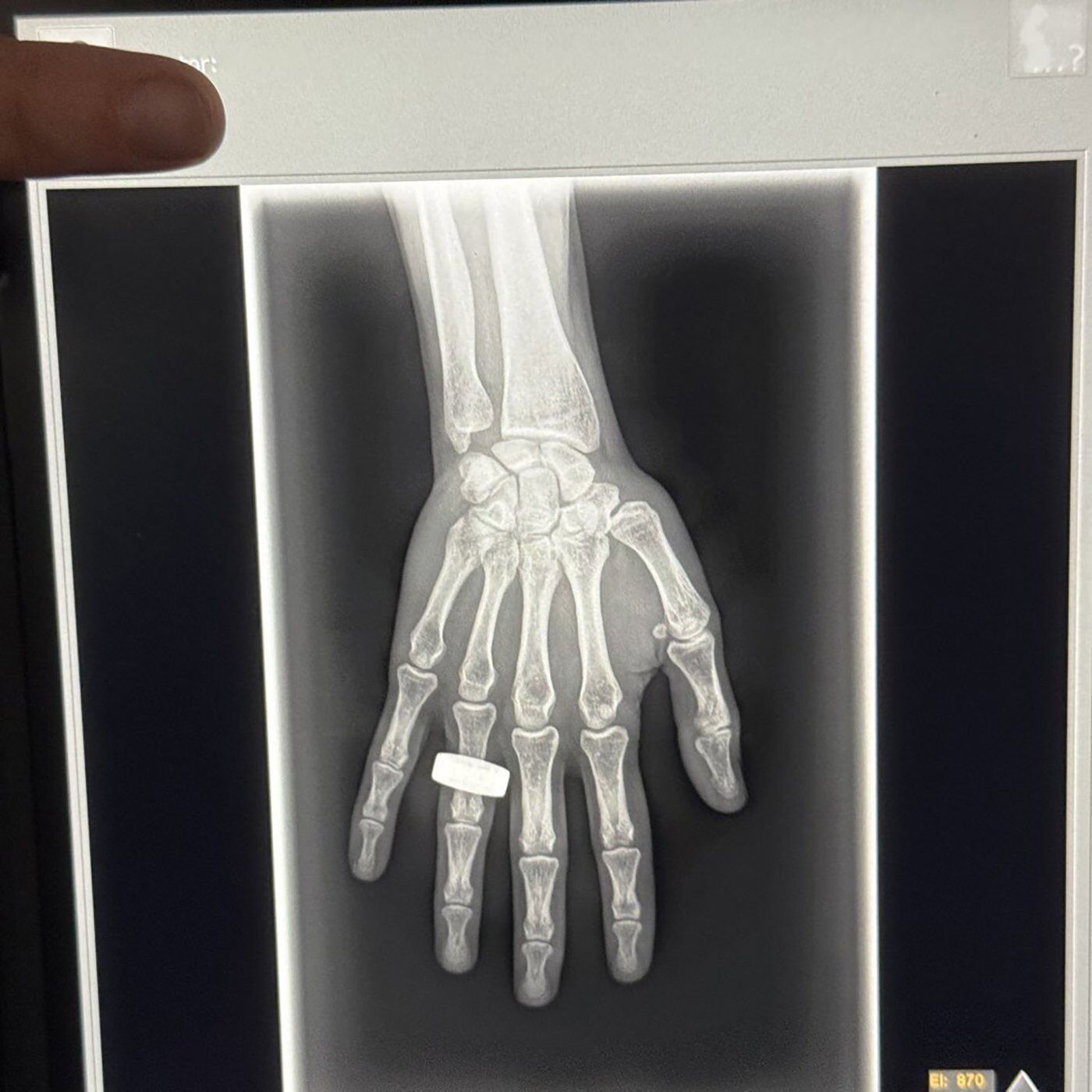 ºÚÁϳԹÏÍø firm KA Imaging claims first X-ray image taken in space